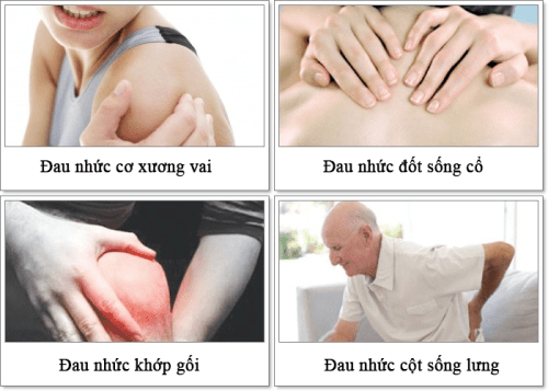 một số bệnh đau xương khớp thường gặp